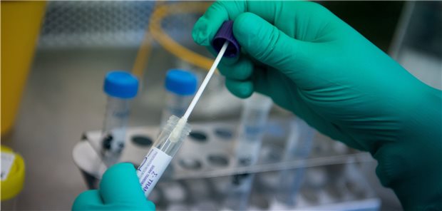 Bei weiterhin hoher Testkapazität sinkt die Zahl der positiven Ergebnisse durchgeführter PCR-Tests auf 0,6 Prozent, so die Akkreditierten Labore in der Medizin.