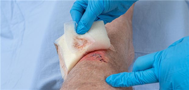 Patient mit einer Wunde am Knie