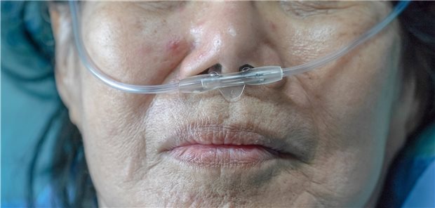 IQWiG sieht Aktualisierungsbedarf beim DMP COPD Beim DMP COPD gibt es laut IQWiG einigen Aktualisierungsbedarf, und zwar auch was die Langzeit-Sauerstofftherapie (LOT) betrifft.