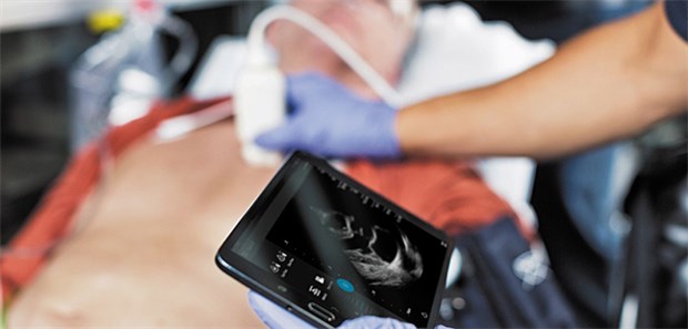 Mobiles Ultraschall nur mit Sonde und App Beim Lumify-System kann die Ultraschallsonde, die die gesamte Hardware enthält, an ein mobiles Endgerät angeschlossen werden.