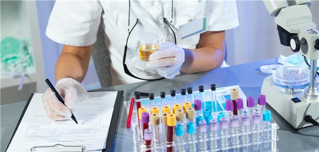 Eine Frau hält eine Urinprobe für einen Urintest auf Prostatakrebs in ihrer Hand.