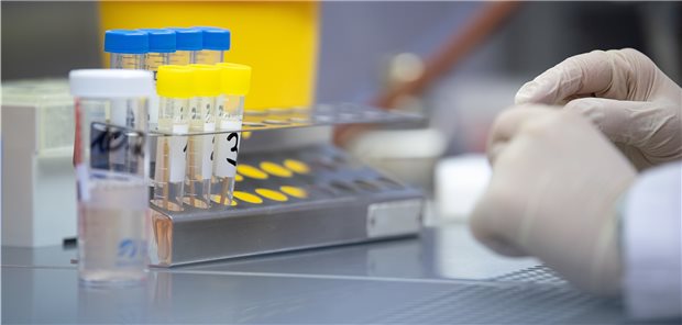 Labore haben noch Puffer für SARS-CoV-2-Tests Beim Testen auf SARS-CoV-2.