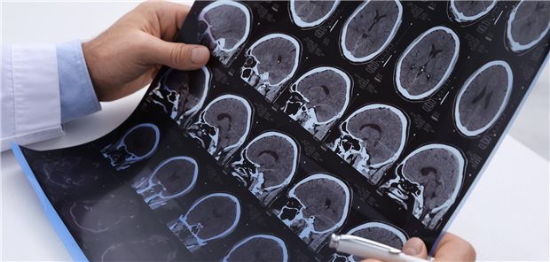 Arzt untersucht MRT-Bilder eines Patienten mit Multipler Sklerose am Tisch in der Klinik, Nahaufnahme
