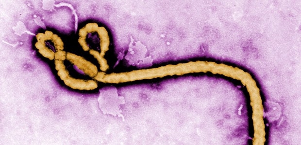 Ebola sind die Grenzen egal Bekanntes Konterfei: Ein Ebolavirion räkelt sich unterm Elektronenmikroskop.