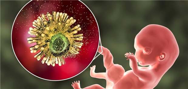 Bekommt eine schwangere Frau HIV diagnostiziert, sollte sie schnellstmöglich an ein HIV-Zentrum überwiesen werden, so Dr. Annette Haberl. Ziel ist eine Reduktion der Viruslast.