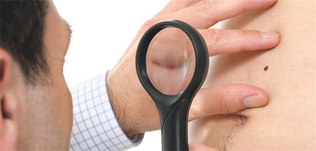 Benutzen Haut- und Hausärzte für das Hautkrebsscreening als Prävention nur die Lupe, ist dies eine Kassenleistung.