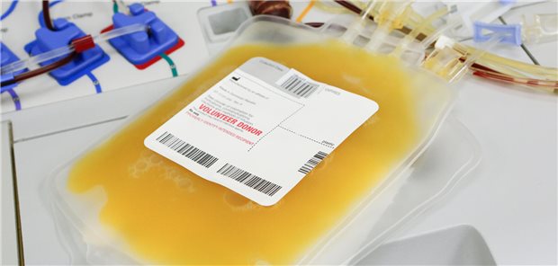 Besonders bei Thrombozytenkonzentraten ist eine Pathogeninaktivierung wichtig, da diese bei Raumtemperatur gelagert werden.