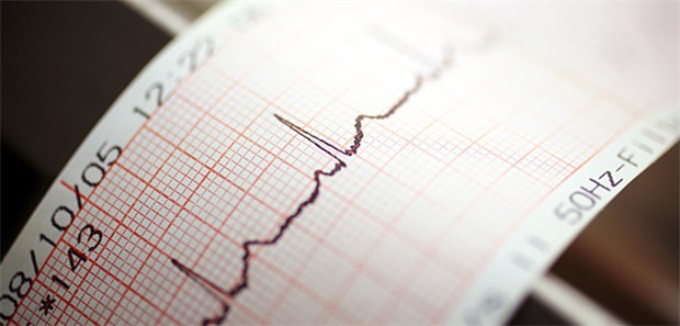 Bessert bei KHK eine Frequenzreduktion die Prognose? Das wurde jetzt in einer Studie überprüft.