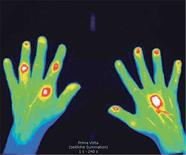 Hand in Hand gegen Rheuma Bestätigung einer Verdachtsdiagnose des Hausarztes durch den Rheumatologen.