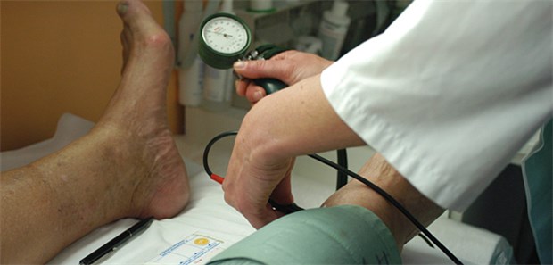ABI toppt CIMT und Kalk-Score Bestimmung des ABI: Der Parameter ist ein guter Schlaganfallrisiko-Indikator.