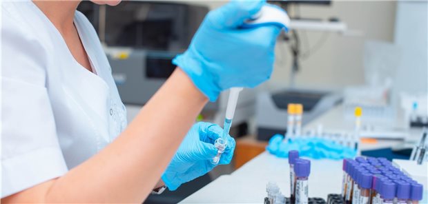 Schilddrüse und SARS-CoV-2: Wo sind die Zusammenhänge? Bestimmung von Schilddrüsenwerten: Sowohl niedriges TSH als auch niedriges fT3 traten in einer Studie bei COVID-19-Patienten mit Fieber häufiger auf.