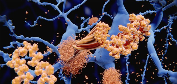 Prävention von familiärer Alzheimerdemenz ist gescheitert Beta-Amyloid-Peptide eignen sich nach neuen Erkenntnissen nicht als Ziel präventiver Therapien.