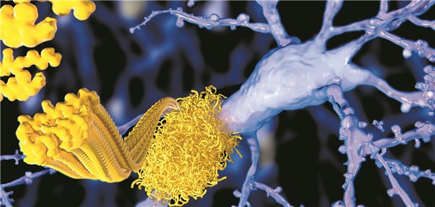 Beta-Amyloid: Weiterhin im Fokus vieler Demenz-Forscher.