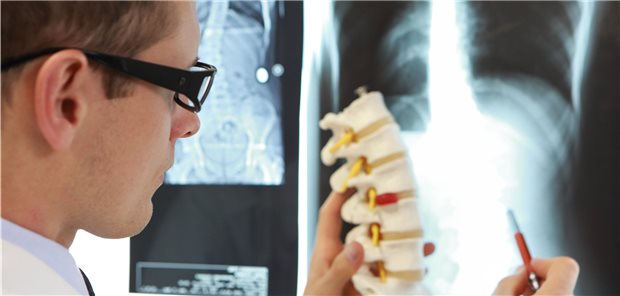 Osteoporose an der Wirbelsäule im Röntgenbild erklärt