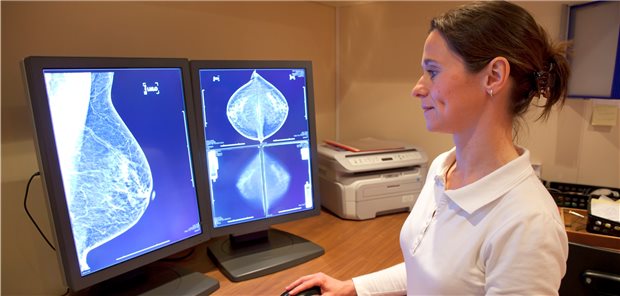 Bewertung von Mammographie-Bildern: Die Früherkennungsstrategie des Mammakarzinoms und eine optimierte Therapie haben die Prognose für betroffene Frauen deutlich verbessert.