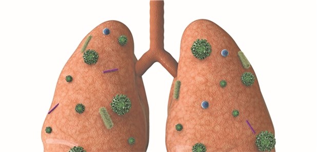 Bei nosokomialer Pneumonie nur selten Kombitherapie nötig Bei nosokomialer Pneumonie nur selten Kombitherapie nötig