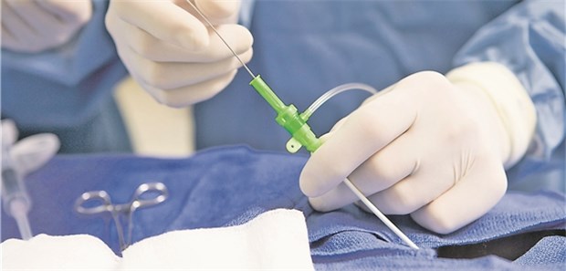 PFO-Verschluss bei "kryptogenem" Schlaganfall: Am Ende doch von Vorteil?