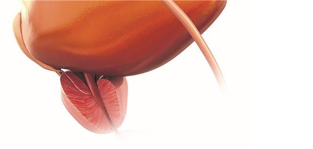 Apalutamid bremst Metastasenbildung