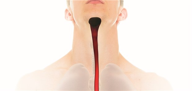 Die übersehene Speisenröhren-Entzündung