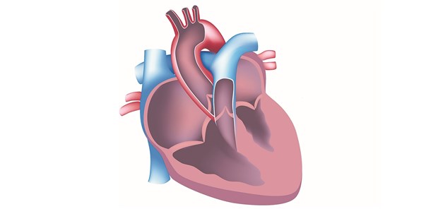 Metformin verringert linksventrikuläre Hypertrophie