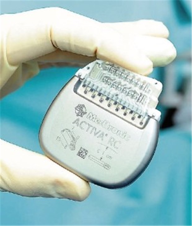 Neuer Schrittmacher lindert zugleich Tremor, Rigor und Akinese bei Parkinson-Patienten Neuer Schrittmacher lindert zugleich Tremor, Rigor und Akinese bei Parkinson-Patienten