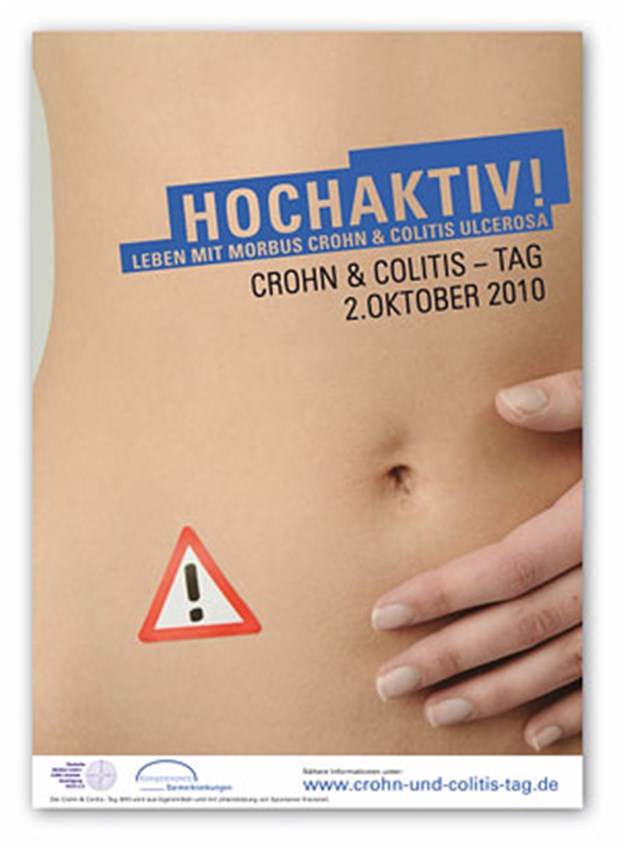 Step up oder Top down bei Morbus Crohn? Step up oder Top down bei Morbus Crohn?