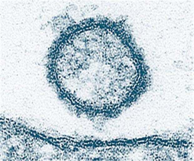 Forscher machen Schmallenberg-Virus sichtbar Forscher machen Schmallenberg-Virus sichtbar