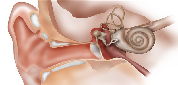Vorteil mit adjuvanter Heparintherapie bei profundem Hörsturz