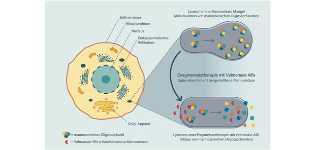 Lamzede® – erste Enzymersatztherapie für Patienten mit Alpha-Mannosidose Lamzede® – erste Enzymersatztherapie für Patienten mit Alpha-Mannosidose