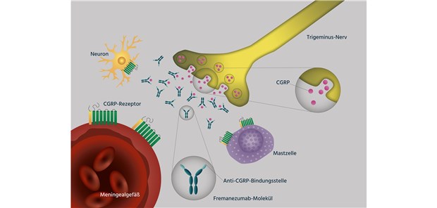 Ajovy® – CGRP-Antikörper zur zielgerichteten Migräneprophylaxe Ajovy® – CGRP-Antikörper zur zielgerichteten Migräneprophylaxe