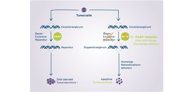 Lynparza® – verlangsamt Progression von rezidivierten Ovarialkarzinomen Lynparza® – verlangsamt Progression von rezidivierten Ovarialkarzinomen
