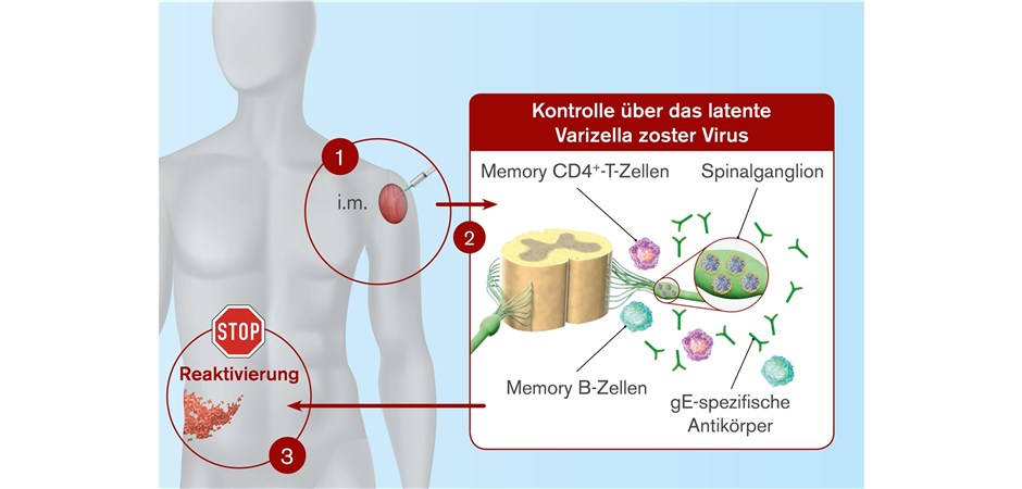 Herpes-zoster-Impfstoff bietet hohen Schutz unabhängig vom Alter