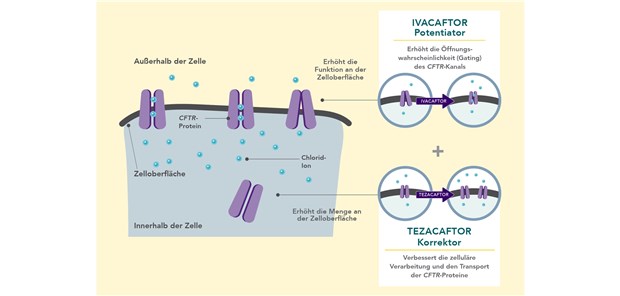 Symkevi® – kausale Therapie für viele Patienten mit Cystischer Fibrose Symkevi® – kausale Therapie für viele Patienten mit Cystischer Fibrose