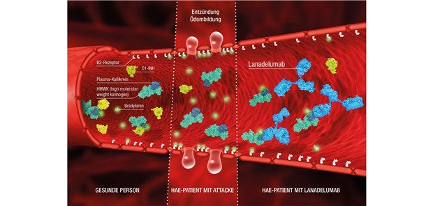 Takhzyro® – erster Antikörper zur Prophylaxe des hereditären Angioödems Takhzyro® – erster Antikörper zur Prophylaxe des hereditären Angioödems