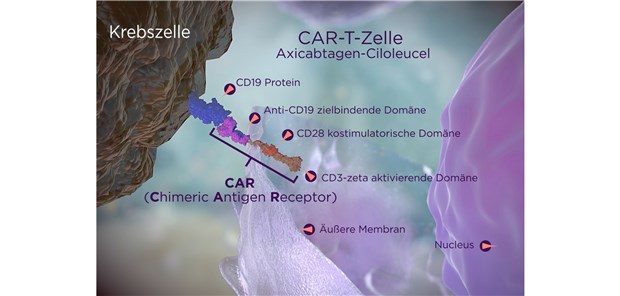 Yescarta®– personalisierte T-Zelltherapie bei fortgeschrittenen B-Zell-Lymphomen Yescarta®– personalisierte T-Zelltherapie bei fortgeschrittenen B-Zell-Lymphomen