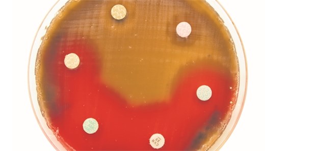Antibiotika-Resistenzen – eine globale Gefahr Antibiotika-Resistenzen – eine globale Gefahr