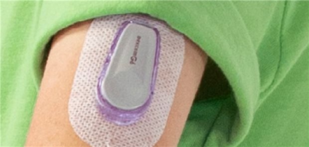 CGM-Sensor mit flexiblen Tragemöglichkeiten CGM-Sensor mit flexiblen Tragemöglichkeiten