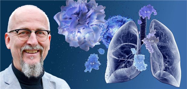 Diagnose Asthma: Behandlungsoption Dupilumab