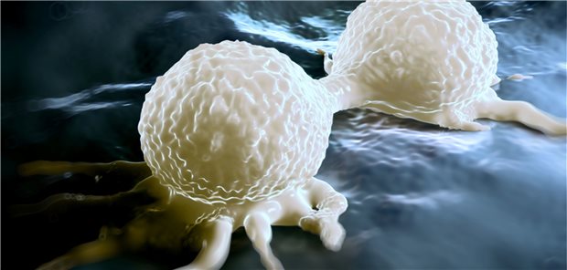 Endokrinbasierte Kombinationstherapie mit Ribociclib verlängert Gesamtüberleben