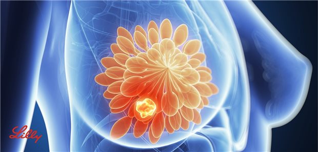 Die Bedeutung von Prognosefaktoren