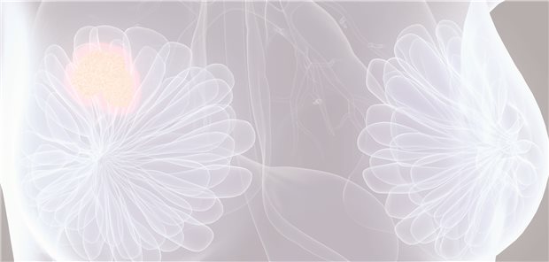 Versorgungsforschung: Neue Daten und hohe Evidenz für Palbociclib