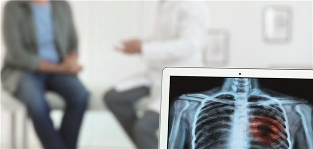 Radiochemo-Immuntherapie mit Durvalumab – Ablauf und Supportivmaßnahmen