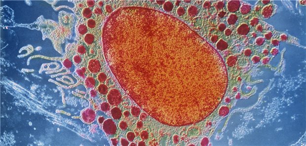 Neue Therapieoption mit KIT D816V-Inhibitor