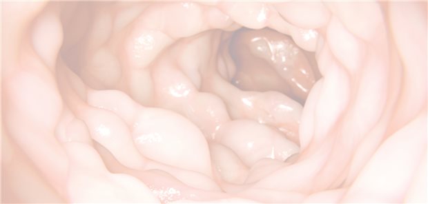 Effektivität von Vedolizumab bei CED