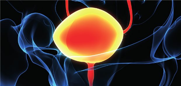 Langzeiterfahrung mit Avelumab als Erstlinien-Erhaltungstherapie