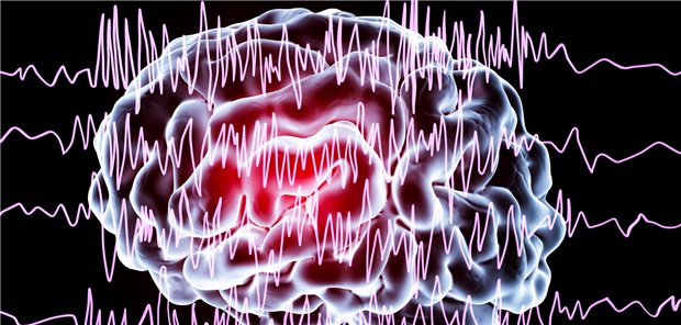 Vorhofflimmern: Epilepsie häufiger unter DOAK als unter Vitamin-K-Antagonist