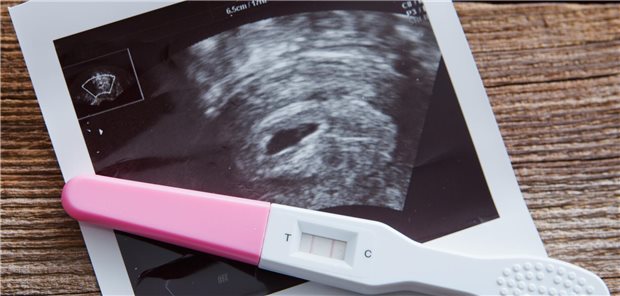 Schwanger nach schwangerschaftsassoziiertem Schlaganfall