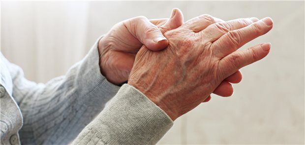 Welche Mittel helfen gegen Arthrose der Hände?
