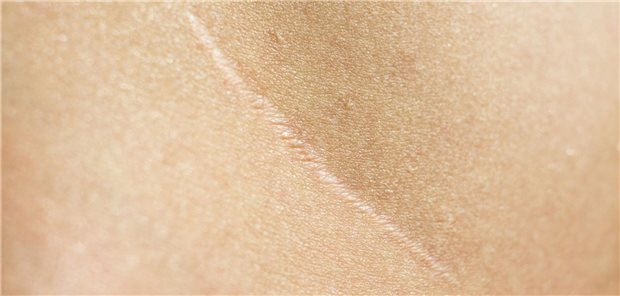 Was bringt die LASH?