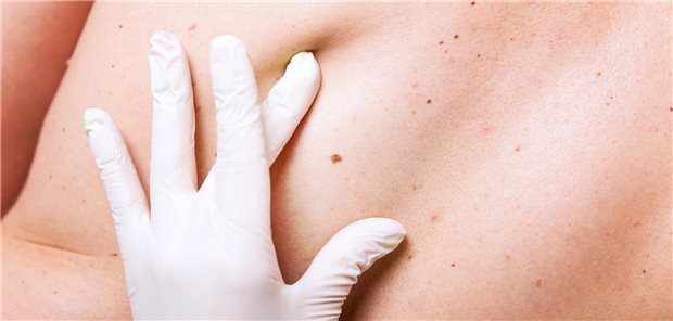 Arbeitsmedizinische Angebotsvorsorge für Außenbeschäftigte?